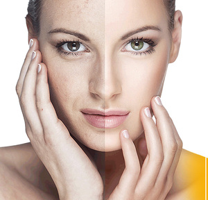 Что собой представляет антиэйдж-терапия