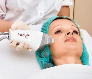 Фракционный термолиз &mdash; метод лазерного омоложения кожи