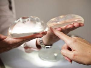 Характеристики и преимущества грудных имплантов &laquo;Ментор&raquo;