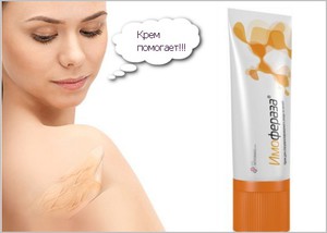 Имофераза или Контрактубекс: что лучше от шрамов и рубцов