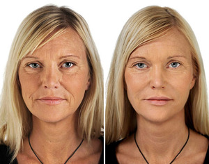 Как эффективно омолодить кожу лица