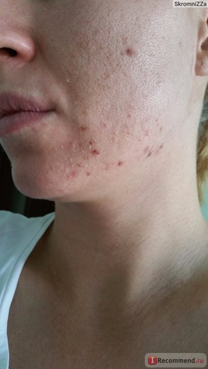 Мануальная чистка лица для красоты кожи