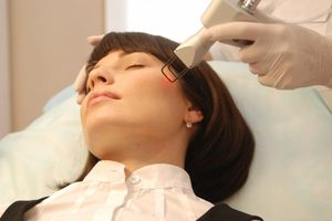 Особенности проведения процедуры фракционного фототермолиза