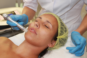 Особенности проведения процедуры микронидлинга