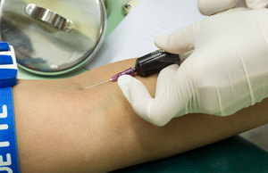 Схема аутогемотерапии, её показания и противопоказания