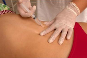 Уколы для похудения и сжигания жира на животе