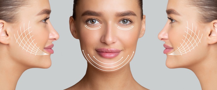 Векторный лифтинг (или биоармирование) против биоревитализации: основные различия между процедурами