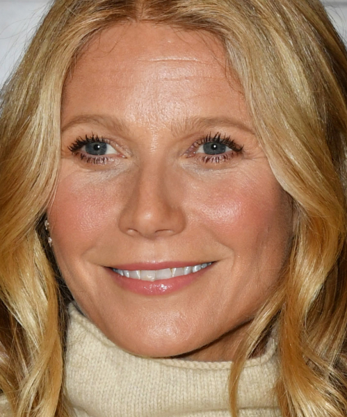 8 звезд, которые совершенно точно не делают ботокс