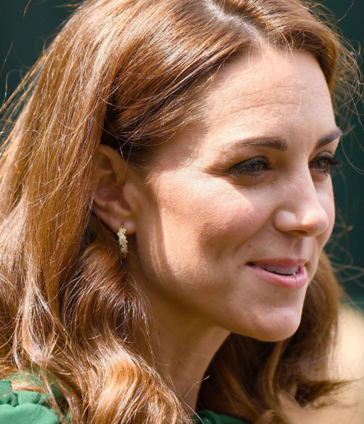 8 звезд, которые совершенно точно не делают ботокс